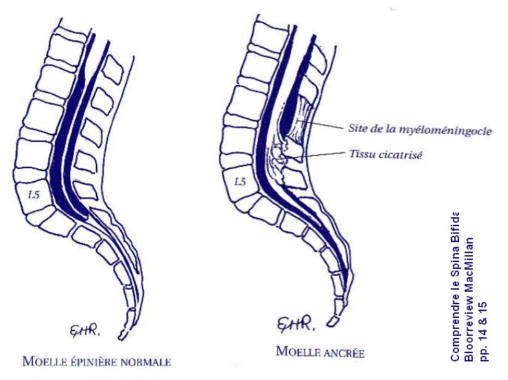 moelle_normale_-_moelle_attachee.jpg