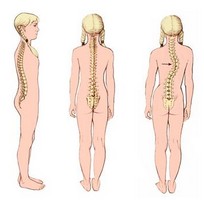 scoliosis_.jpg